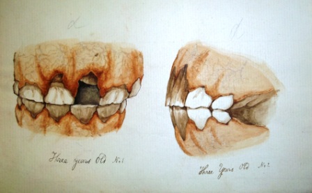 Illustration by Edward Mayhew the teeth of a three year old horse